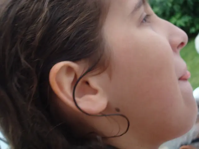 Plex Suffers Another Attack by Media Outlets